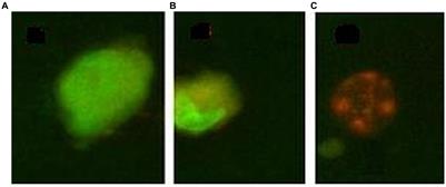 Modifications in cellular viability, DNA damage and stress responses inflicted in cancer cells by copper-64 ions